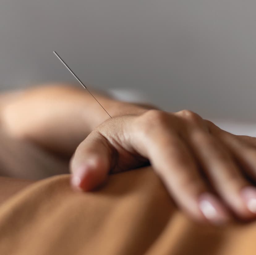 Dry Needling Therapy Team
