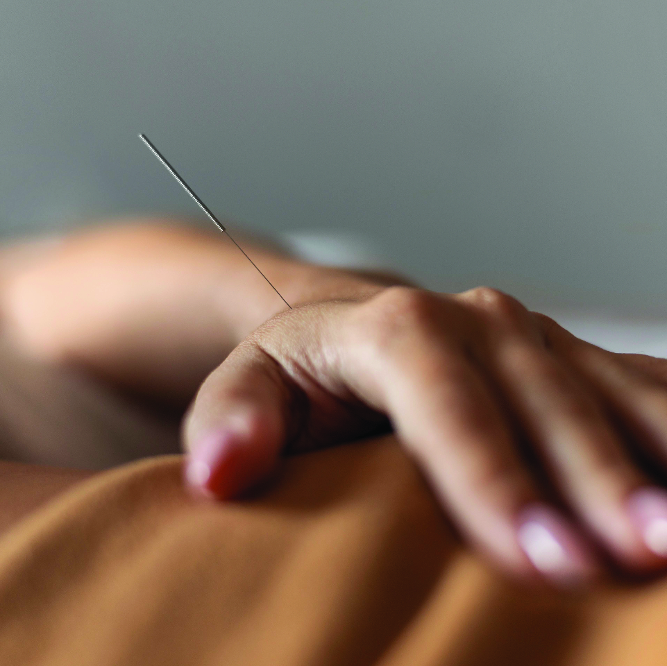 Dry Needling Therapy Team